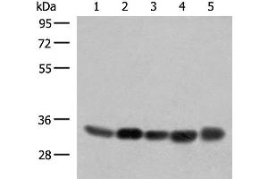 Western blot analysis of 231 PC-3 Hela A375 HepG2 cell lysates using COPE Polyclonal Antibody at dilution of 1:350 (COPE antibody)