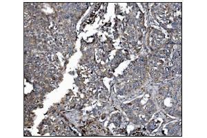 IHC analysis of LRP1B using anti-LRP1B antibody (ABIN7601521). (LRP1B antibody  (AA 3704-4547))