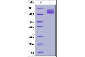 Human MERTK, His Tag on  under reducing (R) condition. (MERTK Protein (AA 21-505) (His tag))