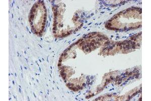 Image no. 1 for anti-Mannose Phosphate Isomerase (MPI) antibody (ABIN1499545) (MPI antibody)