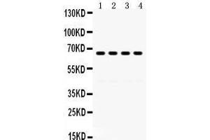 Western Blotting (WB) image for anti-G Protein-Coupled Receptor Kinase 6 (GRK6) (AA 382-417), (C-Term) antibody (ABIN3042435) (GRK6 antibody  (C-Term))
