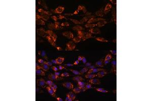 Immunofluorescence analysis of NIH/3T3 cells using Monoamine Oxidase A (Monoamine Oxidase A (MAOA)) antibody (ABIN3021915, ABIN3021916, ABIN3021917 and ABIN6217576) at dilution of 1:100. (Monoamine Oxidase A antibody  (AA 1-260))