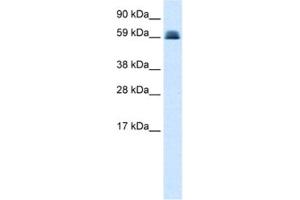 Western Blotting (WB) image for anti-Zinc Finger and BTB Domain Containing 45 (ZBTB45) antibody (ABIN2460150) (ZBTB45 antibody)