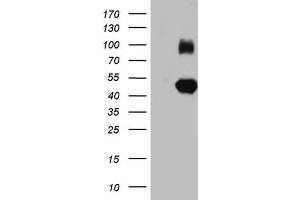 Western Blotting (WB) image for anti-Immunoglobulin Superfamily, Member 11 (IGSF11) (AA 23-241) antibody (ABIN2674593) (IGSF11 antibody  (AA 23-241))