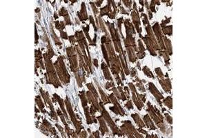 Immunohistochemical staining of human heart muscle with FAM26E polyclonal antibody  shows strong cytoplasmic and membranous positivity in myocytes at 1:500-1:1000 dilution. (FAM26E antibody)