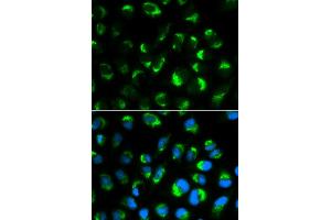 Immunofluorescence analysis of HepG2 cells using SHMT2 antibody (ABIN5970557). (SHMT2 antibody)