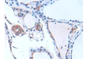 Detection of GbL in Human Thyroid Tissue using Polyclonal Antibody to G Protein Beta Subunit Like Protein (GbL) (GNB1L antibody  (AA 69-247))