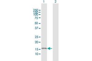Western Blotting (WB) image for anti-NADH Dehydrogenase (Ubiquinone) 1 beta Subcomplex, 6, 17kDa (NDUFB6) (AA 1-128) antibody (ABIN518238)
