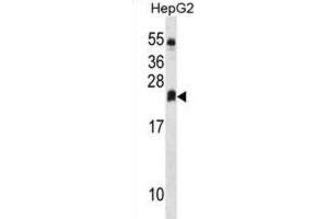 Western Blotting (WB) image for anti-Dehydrogenase/reductase (SDR Family) Member 4 Like 2 (DHRS4L2) antibody (ABIN3000211) (DHRS4L2 antibody)