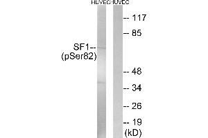 Western blot analysis of extracts from HUVEC cells, treated with anisomycin (25 μg/mL, 30 mins), using SF1 (Phospho-Ser82) antibody. (Splicing Factor 1 antibody  (pSer82))