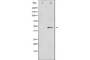 Western blot analysis of Smad3 phosphorylation expression in HT29 whole cell lysates,The lane on the left is treated with the antigen-specific peptide.