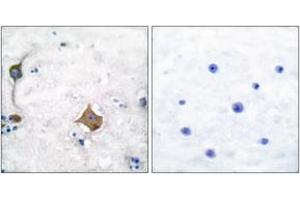 Immunohistochemistry analysis of paraffin-embedded human brain tissue, using Synaptophysin Antibody. (Synaptophysin antibody  (AA 101-150))