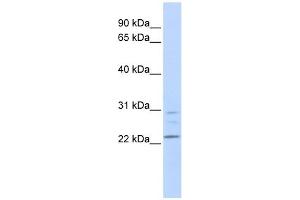 LYPLA1 antibody used at 1 ug/ml to detect target protein. (LYPLA1 antibody  (Middle Region))