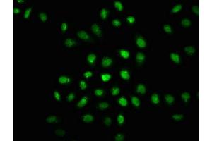 Immunofluorescence staining of Hela cells(treated with 50 mM Calyculin A for 30 min) with ABIN7127689 at 1:100,counter-stained with DAPI. (Recombinant EIF2AK2 antibody  (pThr446))