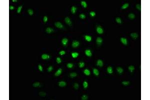 Immunofluorescence staining of Hela cells(treated with 50 mM Calyculin A for 30 min) with ABIN7127689 at 1:100,counter-stained with DAPI. (Recombinant EIF2AK2 antibody  (pThr446))