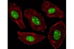 Fluorescent image of A549 cells stained with NPM1 antibody. (NPM1 antibody  (AA 198-226))
