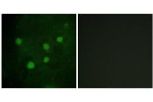 Immunofluorescence analysis of HUVEC cells, using BAF250B antibody. (ARID1B antibody  (Internal Region))