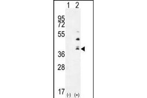 Western blot analysis of TNFSF15 (arrow) using rabbit polyclonal TNFSF15 Antibody (Center) (ABIN655822 and ABIN2845246).