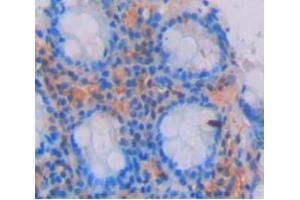 Used in DAB staining on fromalin fixed paraffin- embedded Kidney tissue (GREM2 antibody  (AA 22-168))