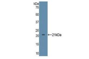 WB of Protein Standard: different control antibodies against Highly purified E. (TNF alpha ELISA Kit)