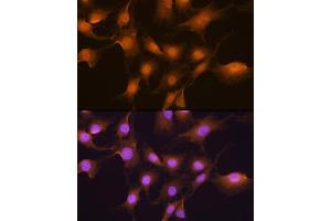 Immunofluorescence analysis of C6 cells using SKP2 Rabbit pAb (ABIN6134430, ABIN6147822, ABIN6147824 and ABIN6223665) at dilution of 1:100. (SKP2 antibody  (AA 1-100))