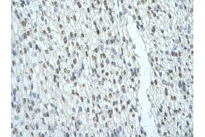 Rabbit Anti-SFRS2B antibody   Paraffin Embedded Tissue: Human Heart cell Cellular Data: cardiac cell of renal tubule Antibody Concentration: 4. (SFRS2B antibody  (Middle Region))