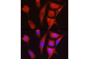 Immunofluorescence analysis of U2OS cells using S6 Ribosomal Protein (RPS6) Rabbit pAb (ABIN6133901, ABIN6147227, ABIN6147228 and ABIN6221687) at dilution of 1:100 (40x lens). (RPS6 antibody  (AA 1-100))
