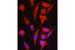 Immunofluorescence analysis of U2OS cells using S6 Ribosomal Protein (RPS6) Rabbit pAb (ABIN6133901, ABIN6147227, ABIN6147228 and ABIN6221687) at dilution of 1:100 (40x lens). (RPS6 antibody  (AA 1-100))