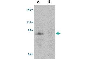 Western blot analysis of JPH4 in mouse brain tissue lysate with JPH4 polyclonal antibody  at 1 ug/mL in (A) the absence and (B) the presence of blocking peptide.