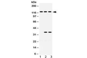 Western blot testing of 1) rat brain, 2) human HeLa and 3) human Jurkat lysate with ARHGEF1 antibody at 0. (ARHGEF1 antibody  (AA 41-71))