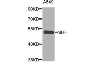 Western blot analysis of extracts of A549 cell line, using SHH antibody. (Sonic Hedgehog antibody)