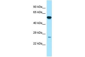 Host:  Rabbit  Target Name:  GSTP1  Sample Type:  Placenta lysates  Antibody Dilution:  1. (GSTP1 antibody  (N-Term))
