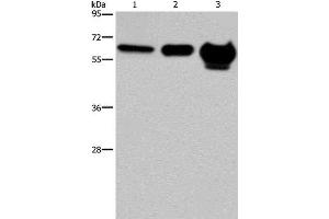 Western Blot analysis of 823 cell, Mouse brain and Human fetal brain tissue using MMP20 Polyclonal Antibody at dilution of 1:400 (MMP20 antibody)