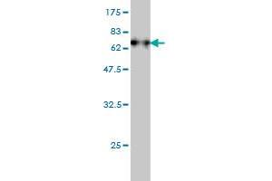 Western Blot detection against Immunogen (74. (Fatty Acid Synthase antibody  (AA 1-439))