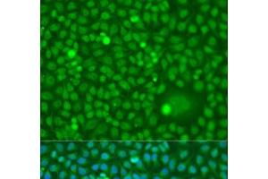 Immunofluorescence analysis of U2OS cells using CDK10 Polyclonal Antibody at dilution of 1:100. (CDK10 antibody)