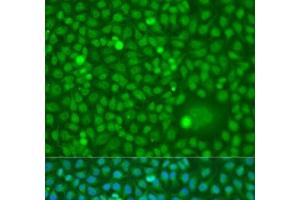 Immunofluorescence analysis of U2OS cells using CDK10 Polyclonal Antibody at dilution of 1:100.
