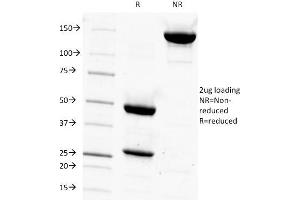 SDS-PAGE Analysis Purified PSA Mouse Monoclonal Antibody (1A7). (Prostate Specific Antigen antibody)