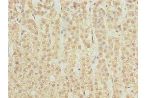 Immunohistochemistry of paraffin-embedded human adrenal gland tissue using ABIN7168896 at dilution of 1:100 (SPTLC2 antibody  (AA 88-562))