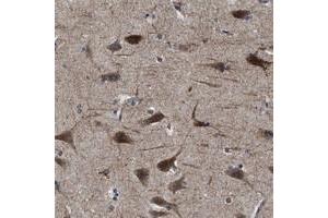 Immunohistochemical staining of human cerebral cortex with SLC35F1 polyclonal antibody  shows strong cytoplasmic positivity in neuronal cells at 1:500-1:1000 dilution.