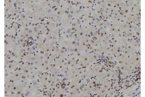 ABIN6277593 at 1/100 staining Human liver tissue by IHC-P. (APRT antibody  (Internal Region))
