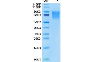IBSP Protein (AA 17-318) (His tag)