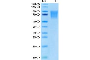 Cynomolgus BSPII on Tris-Bis PAGE under reduced condition. (IBSP Protein (AA 17-318) (His tag))