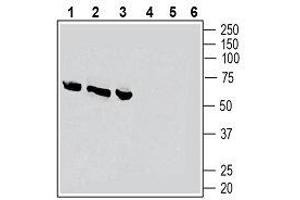 Western Blotting (WB) image for anti-Calcitonin Receptor-Like (CALCRL) (AA 127-140), (Extracellular) antibody (ABIN7042979)