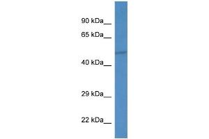 WB Suggested Anti-Ippk Antibody Titration: 1. (IPPK antibody  (C-Term))