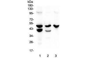 Western blot testing of 1) rat stomach, 2) mouse stomach and 3) mouse SP2/0 lysate with Cathepsin E antibody at 0.