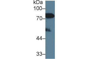 Detection of LBP in Human Serum using Polyclonal Antibody to Lipopolysaccharide Binding Protein (LBP)