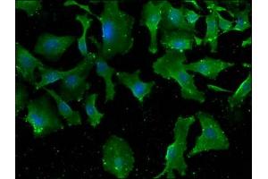 Immunofluorescence staining of U251 cells with ABIN7160647 at 1:100, counter-stained with DAPI. (MTMR3 antibody  (AA 652-899))