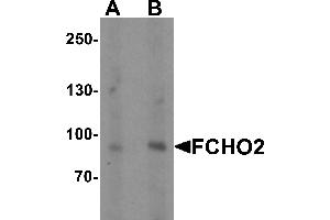 Western blot analysis of FCHO2 in rat heart tissue lysate with FCHO2 antibody at (A) 1 and (B) 2 µg/mL