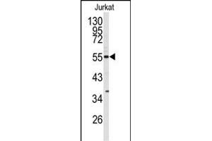 CDK8 Antikörper  (N-Term)