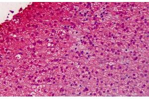Human Adrenal: Formalin-Fixed, Paraffin-Embedded (FFPE) (GNAI1 antibody  (AA 1-355))